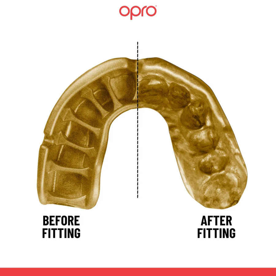 opro bucal gold